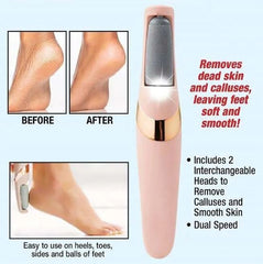 Rechargeable Electric Foot Filer Callus Remover - Smooth, Crack-Free Heels in Minutes