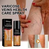South Moon Varicose Spray: Erase Spider Veins & Stop Leg Pain Instantly