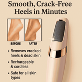 Rechargeable Electric Foot Filer Callus Remover - Smooth, Crack-Free Heels in Minutes