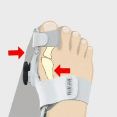 Premium Bunion Corrector & Toe Aligning Splint (Imported)