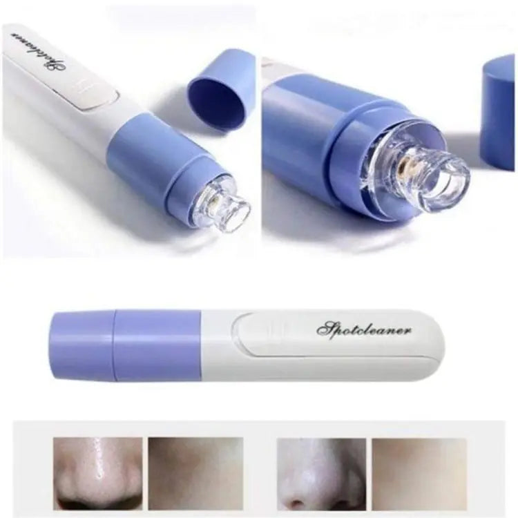 New Electric Blackhead Remover Sucker Black Head Pimple Pore Cleaner Vacuum Blackhead Remover Pore Cleaner (Random color)