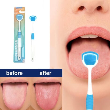 Tongue Cleaner Brush with Soft Silicone Bristles â€“ Oral Hygiene Tool for Fresh Breath &amp; Bacteria Removal -  Tongue Cleaner - Tongue Scraper - Bad Breath Remover - Random Color