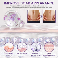 Scar Removal Gel for Old & New Scars – Timilk Regenscar