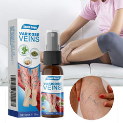 South Moon Varicose Spray: Erase Spider Veins & Stop Leg Pain Instantly