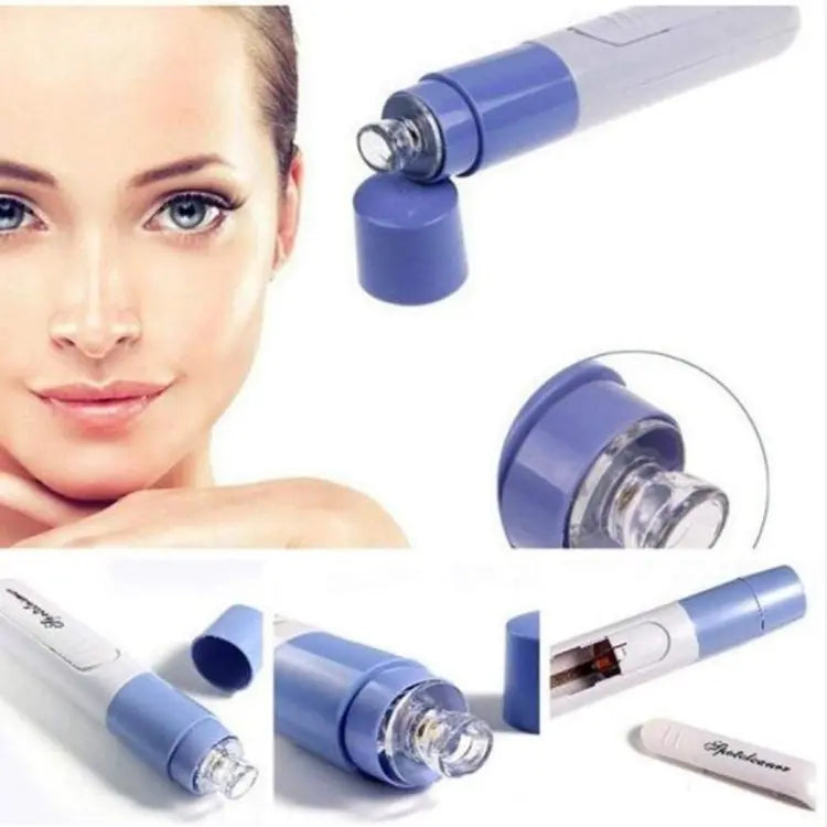 New Electric Blackhead Remover Sucker Black Head Pimple Pore Cleaner Vacuum Blackhead Remover Pore Cleaner (Random color)