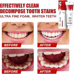 Yayashi  Sp-4 Ultra Whitening Toothpaste Probiotic Stain Remover / Stain Removing Toothpaste, Protects Gums Freshens Breath, for Everyone
