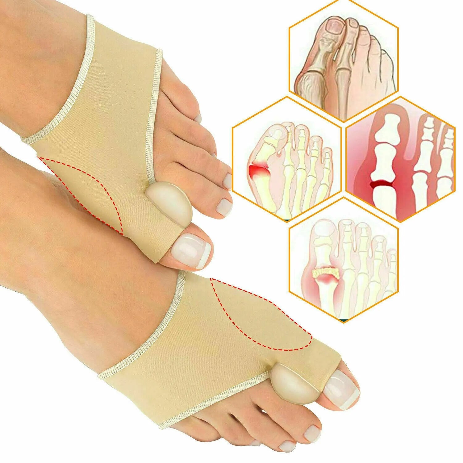 🧦 Smart Bunion Support Socks (Daily Toe Separator & Corrector Sleeve)