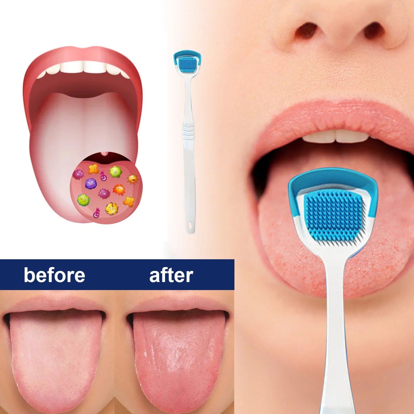 Tongue Cleaner Brush with Soft Silicone Bristles â€“ Oral Hygiene Tool for Fresh Breath &amp; Bacteria Removal -  Tongue Cleaner - Tongue Scraper - Bad Breath Remover - Random Color