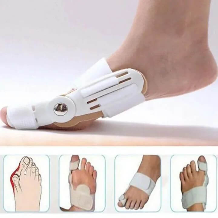 Premium Bunion Corrector & Toe Aligning Splint (Imported)