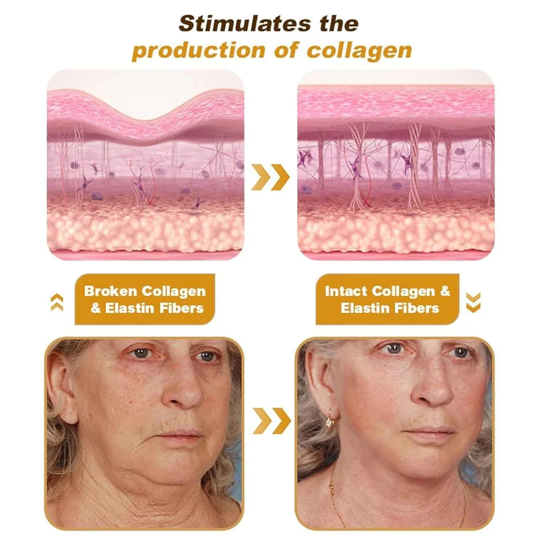 Botox Bee Venom Instant Wrinkle Treatment Cream