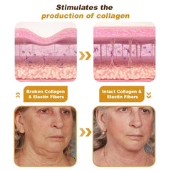 Botox Bee Venom Instant Wrinkle Treatment Cream