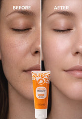 Orange Enzyme Exfoliating Gel That Peels Away Dead Skin in Minutes