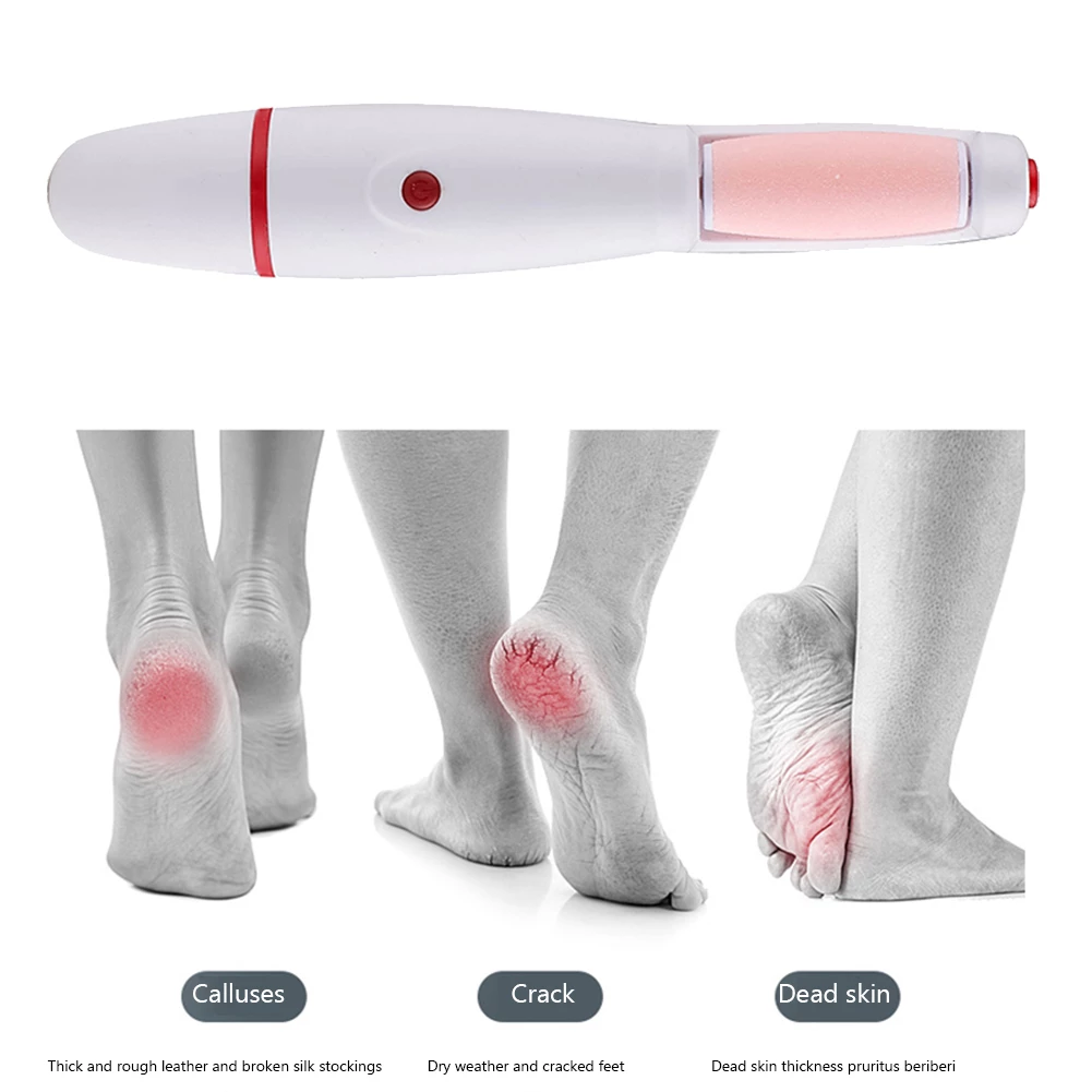 Rechargeable Electric Foot Filer Callus Remover - Smooth, Crack-Free Heels in Minutes