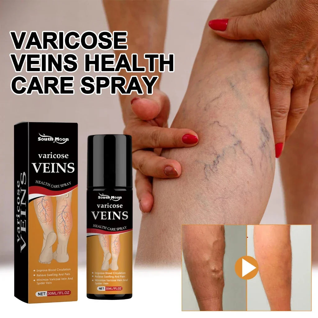 South Moon Varicose Spray: Erase Spider Veins & Stop Leg Pain Instantly