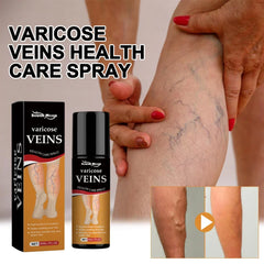 South Moon Varicose Spray: Erase Spider Veins & Stop Leg Pain Instantly